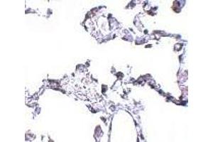 Immunohistochemistry (Paraffin-embedded Sections) (IHC (p)) image for anti-CD81 (CD81) (N-Term) antibody (ABIN499601)