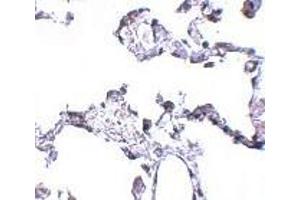 Immunohistochemistry of CD81 in human lung tissue with CD81 antibody at 5 μg/ml.