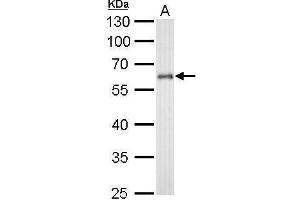 WB Image CYP1B1 antibody detects CYP1B1 protein by Western blot analysis. (CYP1B1 antibody  (Center))