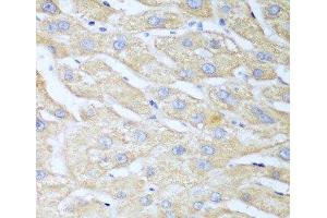 Immunohistochemistry of paraffin-embedded Human liver using NUDT15 Polyclonal Antibody at dilution of 1:100 (40x lens). (NUDT15 antibody)