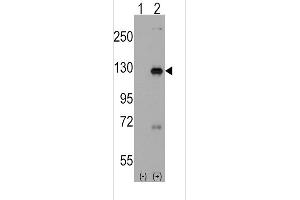 Western blot analysis of DAAM1 using rabbit polyclonal DAAM1 Antibody(Human C-term) using 293 cell lysates (2 ug/lane) either nontransfected (Lane 1) or transiently transfected with the DAAM1 gene (Lane 2).