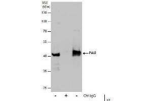 Immunoprecipitation (IP) image for anti-Plasminogen Activator Inhibitor 2 (SERPINB2) (Center) antibody (ABIN2855574)