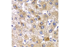 Immunohistochemistry of paraffin-embedded human liver injury using AMY2A antibody (ABIN5975245) at dilution of 1/100 (40x lens). (AMY2A antibody)