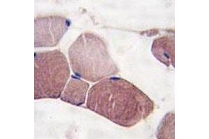 IHC analysis of FFPE human skeletal muscle tissue stained with UCHL3 antibody (UCHL3 antibody  (AA 195-225))