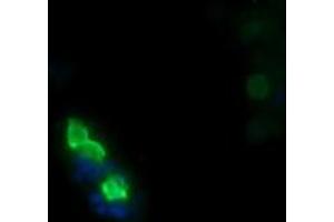 MDM4-binding Protein antibody