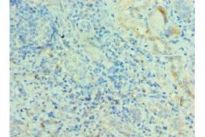 Immunohistochemistry of paraffin-embedded human kidney tissue using ABIN7142389 at dilution of 1:100 (MRPL28 antibody  (AA 1-256))