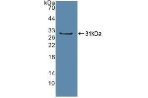 Detection of Recombinant Sp100, Human using Polyclonal Antibody to Sp100 Nuclear Antigen (Sp100) (SP100 antibody  (AA 610-802))
