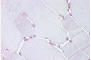 Anti-TEF antibody IHC staining of human skeletal muscle. (TEF antibody  (N-Term))