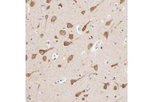 Immunohistochemistry (Formalin/PFA-fixed paraffin-embedded sections) of human lateral ventricle wall with HS3ST1 polyclonal antibody  shows strong cytoplasmic positivity in neuronal cells. (HS3ST1 antibody)