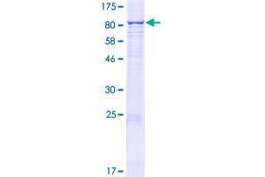 CYP4F22 Protein (AA 1-531) (GST tag)