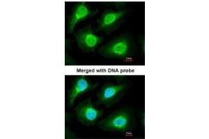 ICC/IF Image Immunofluorescence analysis of paraformaldehyde-fixed HeLa, using 20S Proteasome alpha1, antibody at 1:200 dilution. (Proteasome 20S alpha 1 (Center) antibody)
