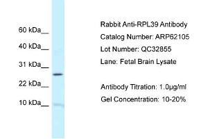 Western Blotting (WB) image for anti-Ribosomal Protein L39 (RPL39) (N-Term) antibody (ABIN2789019) (RPL39 antibody  (N-Term))