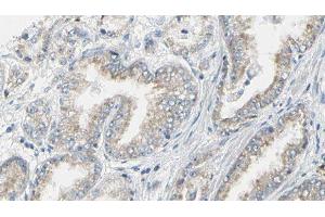 ABIN6276583 at 1/100 staining Human prostate tissue by IHC-P. (RAB5 antibody  (C-Term))