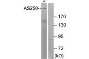Western blot analysis of extracts from Jurkat cells, using AS250 Antibody. (RALGAPA2 antibody  (AA 641-690))