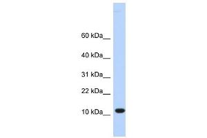 C10ORF57 antibody used at 1 ug/ml to detect target protein. (CJ057 antibody  (Middle Region))