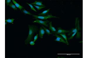 Immunofluorescence of purified MaxPab antibody to PRAME on HeLa cell. (PRAME antibody  (AA 1-509))