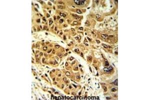 Immunohistochemistry (IHC) image for anti-Lipin 2 (LPIN2) antibody (ABIN3003814) (Lipin 2 antibody)