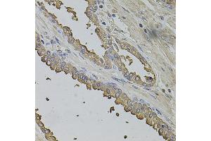 Immunohistochemistry of paraffin-embedded human prostate using FMR1NB antibody (ABIN5972990) at dilution of 1/100 (40x lens). (FMR1NB antibody)