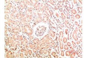 Immunohistochemical analysis of paraffin-embedded Human Kidney Tissue using Collagen IV Mouse mAb diluted at 1:200. (COL4A1 antibody)