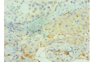 Immunohistochemistry of paraffin-embedded human testis tissue using ABIN7160382 at dilution of 1:100 (BIN1 antibody  (AA 414-593))