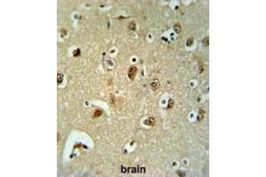 Immunohistochemistry (IHC) image for anti-UDP-Gal:betaGal beta 1,3-Galactosyltransferase Polypeptide 6 (B3GALT6) antibody (ABIN3002204) (B3GALT6 antibody)