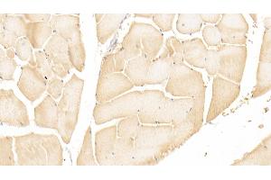 Immunohistochemistry (IHC) image for anti-Protein Kinase, AMP-Activated, gamma 1 Non-Catalytic Subunit (PRKAG1) (AA 70-300) antibody (ABIN7439723)