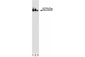 HERC2 anticorps  (AA 1781-1974)