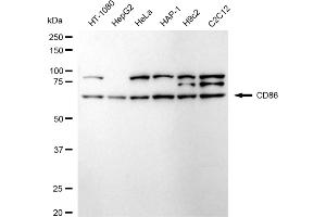 Western blotting analysis using CD86 antibody (ABIN7797986). (Recombinant CD86 antibody)