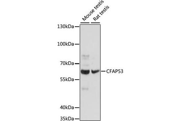 CCDC11 antibody  (AA 1-300)