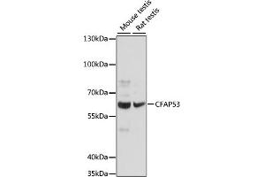 Western blot analysis of extracts of various cell lines, using CF antibody (ABIN7266431) at 1:1000 dilution.