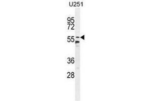 CCDC9 Antibody (N-term) western blot analysis in U251 cell line lysates (35µg/lane). (CCDC9 antibody  (N-Term))
