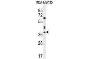 CASP3 Antibody (C-term) western blot analysis in MDA-MB435 cell line lysates (35µg/lane). (Caspase 3 antibody  (C-Term))