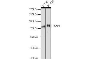 Western blot analysis of extracts of various cell lines, using Y antibody (ABIN6132787, ABIN6150315, ABIN6150320 and ABIN6214108) at 1:1000 dilution. (YAP1 antibody  (AA 155-504))