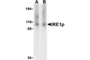 Western blot analysis of IRE1p in Raji cell lysate with AP30446PU-N IRE1p antibody at (A) 1 and (B) 2 μg/ml. (ERN1 antibody  (Intermediate Domain))
