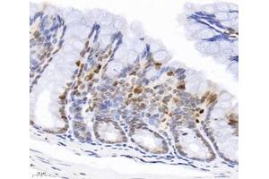 Immunohistochemistry analysis of paraffin-embedded mouse colon using,GINS2 (ABIN7074041) at dilution of 1: 3000