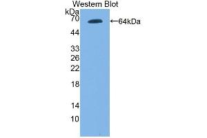 Detection of Recombinant TLR9, Mouse using Polyclonal Antibody to Toll Like Receptor 9 (TLR9) (TLR9 antibody  (AA 26-332))