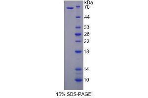 SDS-PAGE (SDS) image for Sphingomyelin phosphodiesterase 2, Neutral Membrane (Neutral Sphingomyelinase) (SMPD2) (AA 1-324) protein (His tag,GST tag) (ABIN4989698) (SMPD2 Protein (AA 1-324) (His tag,GST tag))