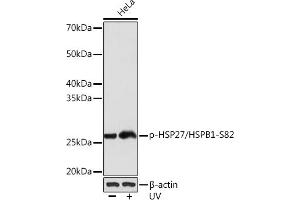 Western blot analysis of extracts of HeLa cells, using Phospho-HSP27/HSPB1-S82 Rabbit mAb (ABIN7267571) at 1:1000 dilution. (HSP27 antibody  (pSer82))