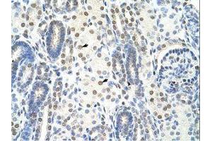 Image no. 1 for anti-Splicing Factor 1 (SF1) (N-Term) antibody (ABIN203234) (Splicing Factor 1 antibody  (N-Term))