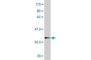 Western Blot detection against Immunogen (36. (UGT1A3 antibody  (AA 30-129))