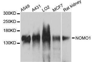 Western blot analysis of extracts of various cells, using NOMO1 antibody. (NOMO1 antibody)