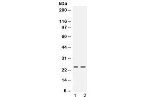 Western blot testing of rat 1) pancreas and 2) NRK lysate with FGF19 antibody at 0. (FGF19 antibody)