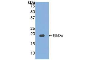 Western blot analysis of recombinant Human RNASE3. (RNASE3 antibody  (AA 30-154))