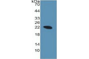 Western Blotting (WB) image for Sonic Hedgehog (SHH) ELISA Kit (ABIN6730870)