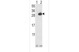 Western blot analysis of UCHL1 using rabbit polyclonal UCHL1-V31 using 293 cell lysates (2 ug/lane) either nontransfected (Lane 1) or transiently transfected with the UCHL1 gene (Lane 2). (UCHL1 antibody  (N-Term))