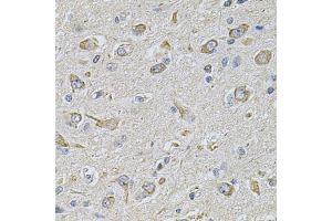 Immunohistochemistry of paraffin-embedded rat brain using FASTKD1 Antibody (ABIN5975129) at dilution of 1/100 (40x lens). (FASTKD1 antibody)