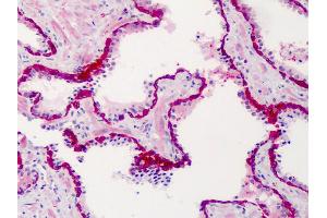 Anti-SLFN12 antibody IHC of human prostate. (SLFN12 antibody  (C-Term))