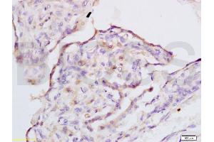 Formalin-fixed and rabbit placenta tissue labeled with Anti-IQGAP1 Polyclonal Antibody, Unconjugated (ABIN737796) at 1:200 followed by conjugation to the secondary antibody and DAB staining (IQGAP1 antibody  (AA 1451-1550))