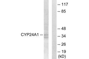 Western blot analysis of extracts from HUVEC cells, using Cytochrome P450 24A1 antibody. (CYP24A1 antibody  (C-Term))