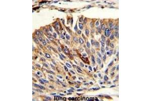 Immunohistochemistry (IHC) image for anti-Vesicle Transport through Interaction with t-SNAREs 1A (VTI1A) antibody (ABIN3003825)